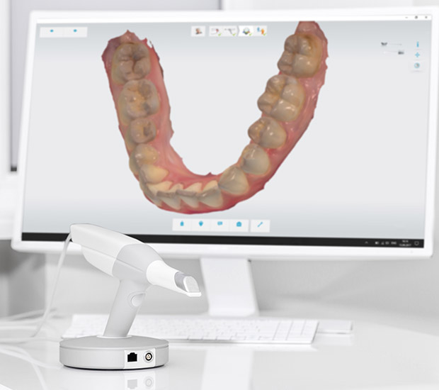 Thousand Oaks 3D Cone Beam and 3D Dental Scans