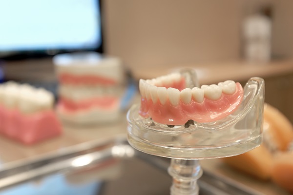 Replacing Upper Or Lower Set Of Teeth With All On