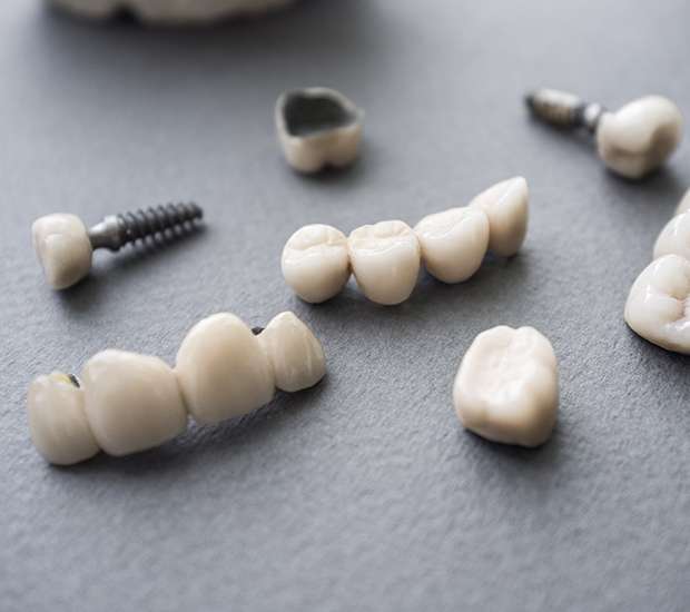 Thousand Oaks The Difference Between Dental Implants and Mini Dental Implants